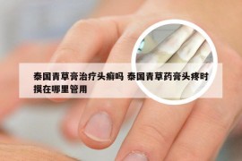 泰国青草膏治疗头癣吗 泰国青草药膏头疼时摸在哪里管用