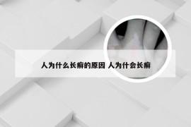 人为什么长癣的原因 人为什会长癣