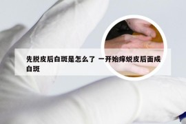 先脱皮后白斑是怎么了 一开始痒蜕皮后面成白斑