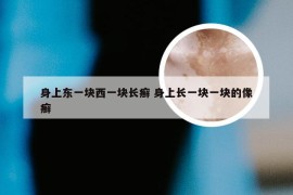 身上东一块西一块长癣 身上长一块一块的像癣