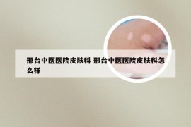 邢台中医医院皮肤科 邢台中医医院皮肤科怎么样