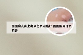 圈圈癣人身上出来怎么治最好 圈圈癣用什么药膏