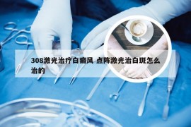 308激光治疗白癜风 点阵激光治白斑怎么治的