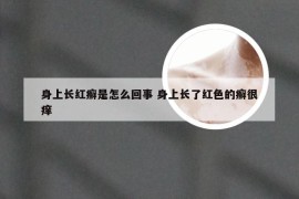 身上长红癣是怎么回事 身上长了红色的癣很痒