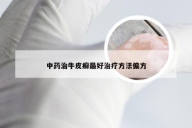 中药治牛皮癣最好治疗方法偏方