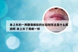 身上长的一两颗像癣似的化验阳性这是什么原因呢 身上长了像癣一样