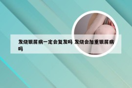 发烧银屑病一定会复发吗 发烧会加重银屑病吗