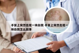 手背上突然出现一块白斑 手背上突然出现一块白斑怎么回事