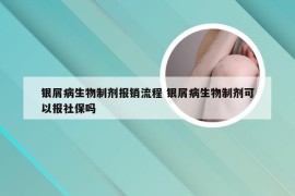 银屑病生物制剂报销流程 银屑病生物制剂可以报社保吗