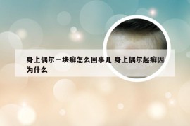 身上偶尔一块癣怎么回事儿 身上偶尔起癣因为什么