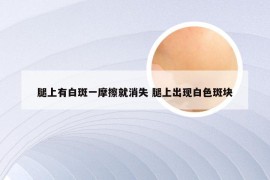 腿上有白斑一摩擦就消失 腿上出现白色斑块