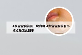 4岁宝宝胸前有一块白斑 4岁宝宝胸前有小红点是怎么回事