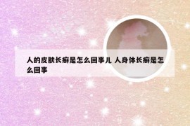 人的皮肤长癣是怎么回事儿 人身体长癣是怎么回事