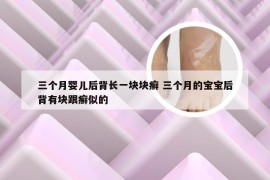 三个月婴儿后背长一块块癣 三个月的宝宝后背有块跟癣似的