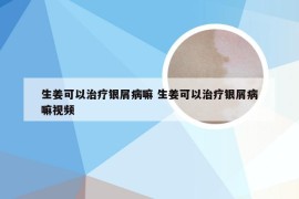 生姜可以治疗银屑病嘛 生姜可以治疗银屑病嘛视频