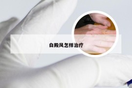 白殿风怎样治疗