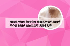 糠酸莫米松乳膏的功效 糠酸莫米松乳膏的功效作用剥脱式皮肤炎症可以用啥乳膏