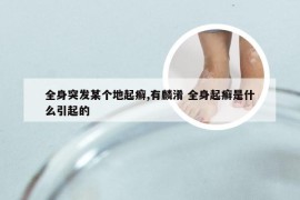 全身突发某个地起癣,有麟淆 全身起癣是什么引起的