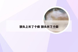 额头上长了个癣 额头长了个藓