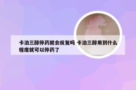 卡泊三醇停药就会反复吗 卡泊三醇用到什么程度就可以停药了