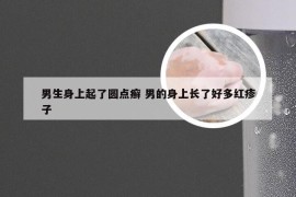 男生身上起了圆点癣 男的身上长了好多红疹子