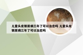 儿童头皮银屑病三年了可以治愈吗 儿童头皮银屑病三年了可以治愈吗