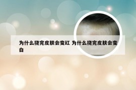 为什么挠完皮肤会变红 为什么挠完皮肤会变白