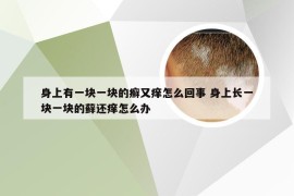 身上有一块一块的癣又痒怎么回事 身上长一块一块的藓还痒怎么办