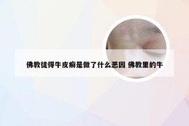 佛教徒得牛皮癣是做了什么恶因 佛教里的牛