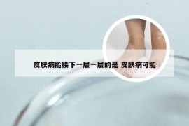 皮肤病能接下一层一层的是 皮肤病可能