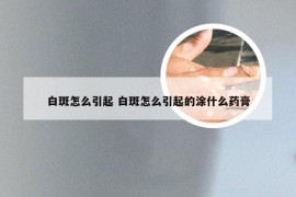 白斑怎么引起 白斑怎么引起的涂什么药膏