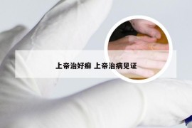 上帝治好癣 上帝治病见证