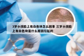 3岁小孩脸上有白色块怎么回事 三岁小孩脸上有白色块是什么原因引起的