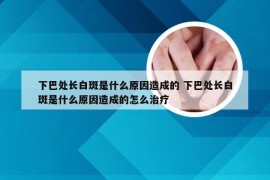 下巴处长白斑是什么原因造成的 下巴处长白斑是什么原因造成的怎么治疗