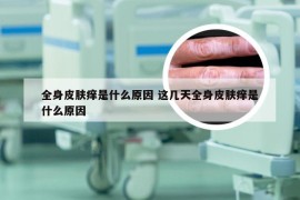 全身皮肤痒是什么原因 这几天全身皮肤痒是什么原因