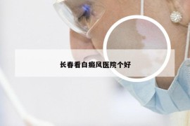 长春看白癜风医院个好