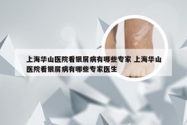 上海华山医院看银屑病有哪些专家 上海华山医院看银屑病有哪些专家医生