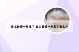 身上长癣一年多了 身上长癣一年多了怎么办