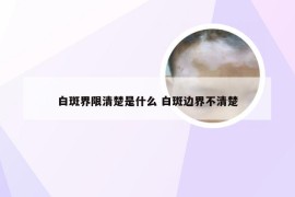 白斑界限清楚是什么 白斑边界不清楚