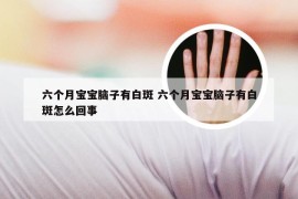 六个月宝宝脑子有白斑 六个月宝宝脑子有白斑怎么回事