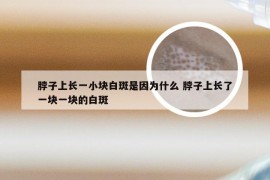 脖子上长一小块白斑是因为什么 脖子上长了一块一块的白斑