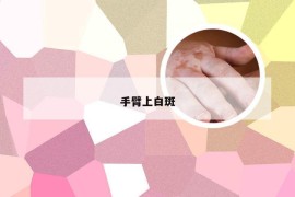 手臂上白斑