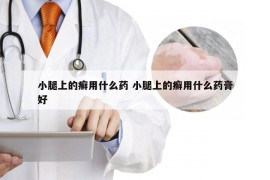 小腿上的癣用什么药 小腿上的癣用什么药膏好