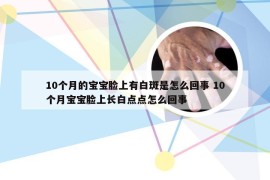 10个月的宝宝脸上有白斑是怎么回事 10个月宝宝脸上长白点点怎么回事