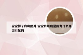 宝宝得了白斑图片 宝宝白斑病是因为什么原因引起的