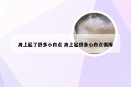 身上起了很多小白点 身上起很多小白点很痒