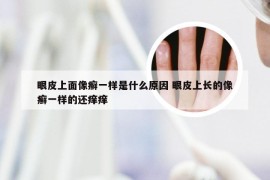 眼皮上面像癣一样是什么原因 眼皮上长的像癣一样的还痒痒