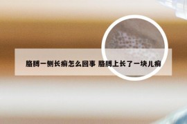 胳膊一侧长癣怎么回事 胳膊上长了一块儿癣