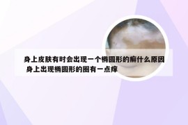 身上皮肤有时会出现一个椭圆形的癣什么原因 身上出现椭圆形的圈有一点痒