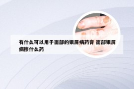 有什么可以用于面部的银屑病药膏 面部银屑病擦什么药